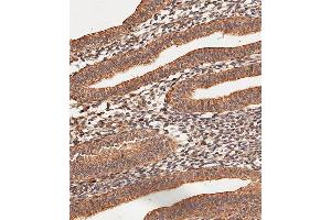 Immunohistochemical analysis of paraffin-embedded Human uterus tissue using A performed on the Leica® BOND RXm.