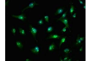 Immunofluorescence staining of U251 cells with ABIN7171462 at 1:100, counter-stained with DAPI. (TIAM2 anticorps  (AA 1500-1627))