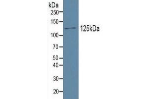 Mouse Capture antibody from the kit in WB with Positive Control: Human testis tissue. (PDGFRA Kit ELISA)