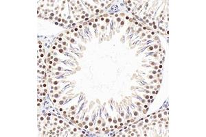 Immunohistochemistry of paraffin embedded rat testis using PP4R2 (ABIN7075284) at dilution of 1:2000 (320x lens) (PPP4R2 anticorps)