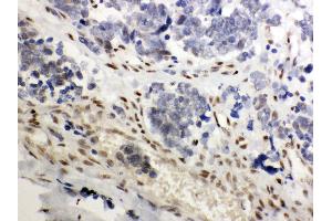Immunohistochemistry (Paraffin-embedded Sections) (IHC (p)) image for anti-Nuclear Receptor Subfamily 3, Group C, Member 1 (Glucocorticoid Receptor) (NR3C1) (AA 20-199) antibody (ABIN3043371) (Glucocorticoid Receptor anticorps  (AA 20-199))