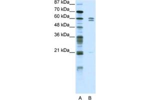 Western Blotting (WB) image for anti-FEZ Family Zinc Finger 2 (FEZF2) antibody (ABIN2461886) (FEZF2 anticorps)
