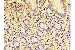 Immunohistochemistry of paraffin-embedded human small intestine tissue using ABIN7152252 at dilution of 1:100 (EXOC2 anticorps  (AA 1-220))