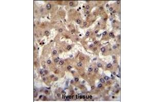 PREF6 Antibody (C-term) (ABIN655365 and ABIN2844922) immunohistochemistry analysis in formalin fixed and paraffin embedded human liver tissue followed by peroxidase conjugation of the secondary antibody and DAB staining. (PRAMEF6 anticorps  (C-Term))