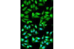 Immunofluorescence analysis of HeLa cell using GSS antibody. (Glutathione Synthetase anticorps  (AA 1-474))