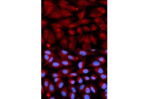 Immunofluorescence analysis of U2OS cells using CD70 antibody (ABIN5971064).