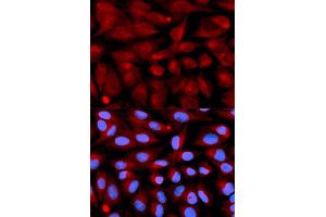 Immunofluorescence analysis of U2OS cells using CD70 antibody (ABIN5971064). (CD70 anticorps)