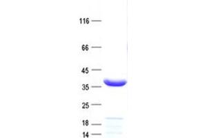 Validation with Western Blot