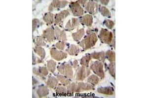 COCH Antibody (Center) immunohistochemistry analysis in formalin fixed and paraffin embedded human skeletal muscle followed by peroxidase conjugation of the secondary antibody and DAB staining. (COCH anticorps  (Middle Region))