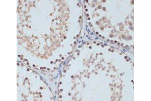 Immunohistochemistry of paraffin-embedded Rat testis using Phospho-STAT1(S727) Polyclonal Antibody at dilution of 1:100 (40x lens).