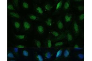 Immunofluorescence analysis of U-2 OS cells using DUT Polyclonal Antibody at dilution of 1:100 (40x lens).