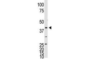 Image no. 1 for anti-Neuronal Differentiation 1 (NEUROD1) (C-Term) antibody (ABIN357406) (NEUROD1 anticorps  (C-Term))