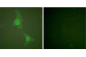 Immunofluorescence analysis of HeLa cells, using ADD1 (Ab-726) Antibody. (alpha Adducin anticorps  (AA 688-737))