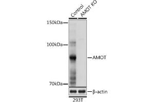 Western blot analysis of extracts from normal (control) and AMOT Rabbit pAb knockout (KO) 293T cells, using AMOT Rabbit pAb antibody (ABIN6128973, ABIN6136838, ABIN6136839 and ABIN6224101) at 1:1000 dilution.