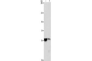 Gel: 8 % SDS-PAGE, Lysate: 40 μg, Lane 1-2: Mouse liver tissue, Mouse kidney tissue, Primary antibody: ABIN7128351(ALDH8A1 Antibody) at dilution 1/550, Secondary antibody: Goat anti rabbit IgG at 1/8000 dilution, Exposure time: 3 seconds (ALDH8A1 anticorps)