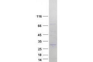 Validation with Western Blot