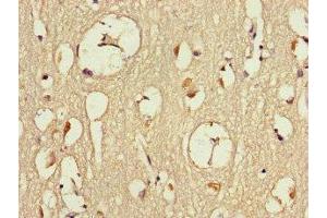 Immunohistochemistry of paraffin-embedded human brain tissue using ABIN7150100 at dilution of 1:100 (Dmx-Like 2 anticorps  (AA 2471-2657))