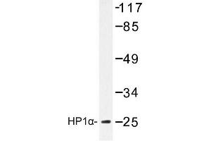 Image no. 1 for anti-Chromobox Homolog 5 (CBX5) antibody (ABIN272193) (CBX5 anticorps)
