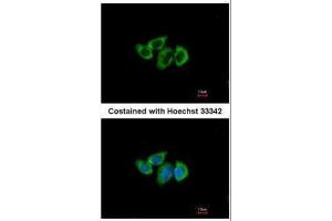 ICC/IF Image Immunofluorescence analysis of methanol-fixed A549, using RPL3, antibody at 1:500 dilution. (RPL3 anticorps)