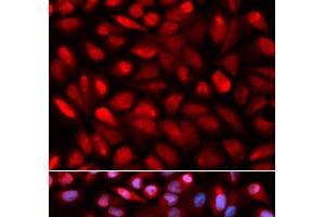 Immunofluorescence analysis of U2OS cells using PCBP2 Polyclonal Antibody (PCBP2 anticorps)