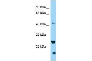 WB Suggested Anti-IZUMO4 Antibody Titration: 1. (IZUMO4 anticorps  (C-Term))