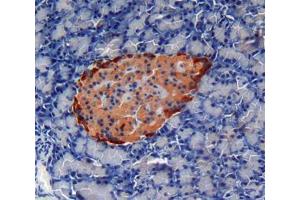 Used in DAB staining on fromalin fixed paraffin- embedded pancreas tissue (Cardiotrophin 1 anticorps  (AA 1-203))