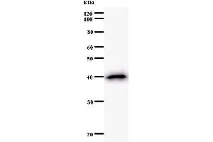 Western Blotting (WB) image for anti-Small Nuclear RNA Activating Complex, Polypeptide 4, 190kDa (SNAPC4) antibody (ABIN930927) (SNAPC4 anticorps)