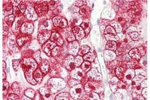 Human Adrenal: Formalin-Fixed, Paraffin-Embedded (FFPE)