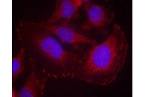 Immunofluorescence staining of methanol-fixed Hela cells using PLC-g1(phospho-Tyr771) Antibody. (Phospholipase C gamma 1 anticorps  (pTyr771))