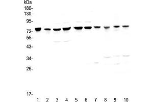 Western blot testing of human 1) HeLa, 2) placenta, 3) COLO-320, 4) HepG2, 5) PANC-1, 6) SGC-7901, 7) MBA-MD-231, 8) rat kidney, 9) mouse heart and 10) mouse kidney with PARN antibody at 0. (PARN anticorps)