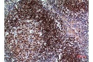 Immunohistochemistry (IHC) analysis of paraffin-embedded Human Tonsil, antibody was diluted at 1:100. (PAX5 anticorps  (Internal Region))