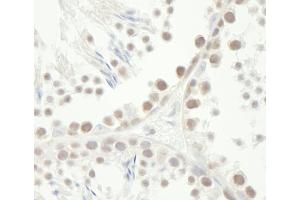 Immunohistochemistry (IHC) image for anti-Checkpoint Kinase 1 (CHEK1) (AA 250-300) antibody (ABIN7448476) (CHEK1 anticorps  (AA 250-300))