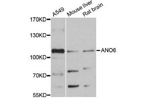 Western blot analysis of extracts of various cell lines, using ANO6 antibody (ABIN6291638) at 1:3000 dilution. (Anoctamin 6 anticorps)