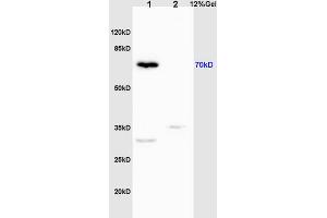 L1 mouse liver lysates L2 rat brain lysates probed with Anti Phospho-IRAK1 (Thr209) Polyclonal Antibody, Unconjugated (ABIN742658) at 1:200 overnight at 4 °C.