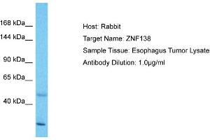 Host: Rabbit Target Name: ZNF138 Sample Type: Esophagus Tumor lysates Antibody Dilution: 1. (ZNF138 anticorps  (Middle Region))