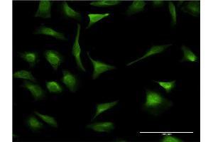 Immunofluorescence of monoclonal antibody to XBP1 on HeLa cell. (XBP1 anticorps  (AA 123-225))