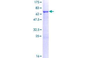 Image no. 1 for Leucine Rich Repeat Containing 2 (LRRC2) (AA 1-371) protein (GST tag) (ABIN1309749)
