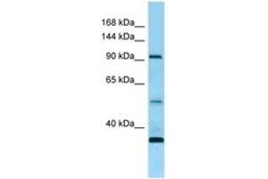 Image no. 1 for anti-Receptor Tyrosine Kinase-Like Orphan Receptor 1 (ROR1) (AA 155-204) antibody (ABIN6748473) (ROR1 anticorps  (AA 155-204))