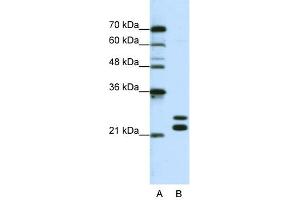 CSDC2 anticorps  (N-Term)
