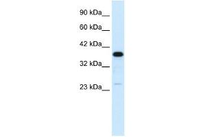 C4BPB antibody used at 1 ug/ml to detect target protein. (C4BPB anticorps  (N-Term))