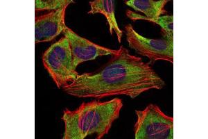 Immunofluorescence analysis of Hela cells using NEFL mouse mAb (green). (NEFL anticorps)