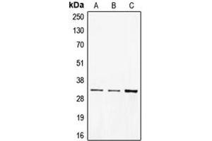 Western blot analysis of CD40 expression in BJAB (A), A431 (B), Ramos (C) whole cell lysates. (CD40 anticorps  (C-Term))