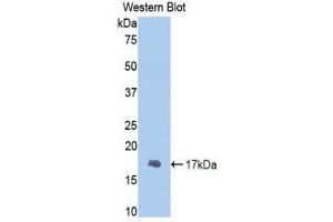 Western Blotting (WB) image for anti-Fibrinogen beta Chain (FGB) (AA 29-118) antibody (ABIN1858856)