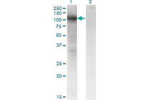 Western Blot analysis of VCAM1 expression in transfected 293T cell line by VCAM1 monoclonal antibody (M04), clone 1H6.