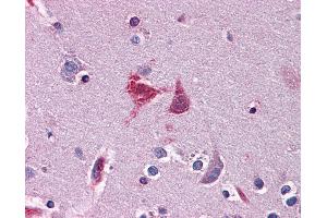 anti-WD Repeat Domain 20 (WDR20) (AA 1-570) antibody