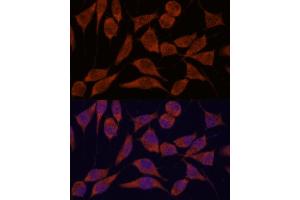 anti-Trafficking Protein Particle Complex 6A (TRAPPC6A) (AA 1-173) antibody