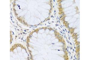 Immunohistochemistry of paraffin-embedded Human colon using ARL6 Polyclonal Antibody at dilution of 1:100 (40x lens). (ARL6 anticorps)