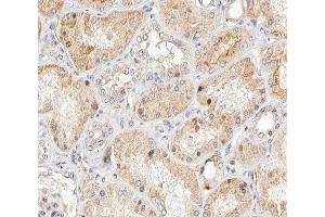 ABIN6266570 at 1/200 staining human kidney tissue sections by IHC-P.
