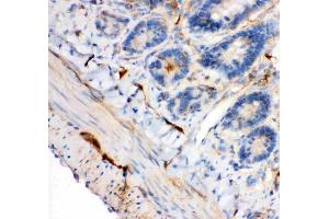 Anti-IRS1 antibody, (ABIN3043251), IHC(P)IHC(P): Rat Intestine Tissue