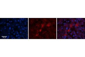 Rabbit Anti-C19orf10 Antibody  Catalog Number: ARP63969_P050 Formalin Fixed Paraffin Embedded Tissue: Human Adult Liver  Observed Staining: Cytoplasm in hepatocytes, moderate tissue distribution, resemble Golgi structures  Primary Antibody Concentration: 1:100 Secondary Antibody: Donkey anti-Rabbit-Cy3 Secondary Antibody Concentration: 1:200 Magnification: 20X Exposure Time: 0.